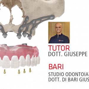 RIABILITAZIONI CON IUXTA-3D