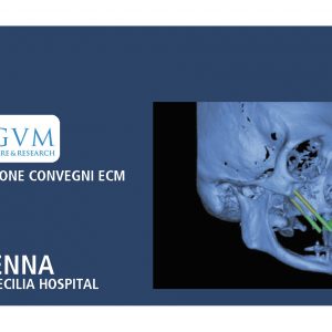 TRATTAMENTO DEL MASCELLARE GRAVEMENTE ATROFICO MEDIANTE L’USO DI IMPIANTI ZIGOMATICI